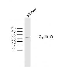Anti-Cyclin G antibody