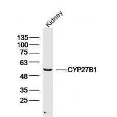 Anti-CYP27B1 antibody