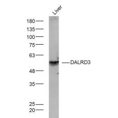 Anti-DALRD3 antibody