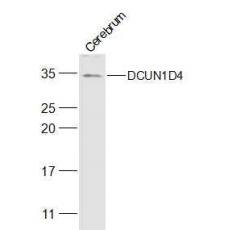 Anti-DCUN1D4 antibody