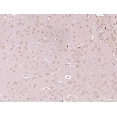 Anti-Deltex 1 antibody