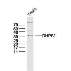 Anti-DHPS1 antibody