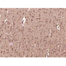 Anti-DHX36 antibody