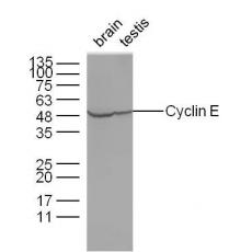 Anti-Cyclin E1 antibody