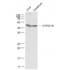 Anti-CYP2C18 antibody