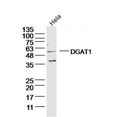 Anti-DGAT1 antibody