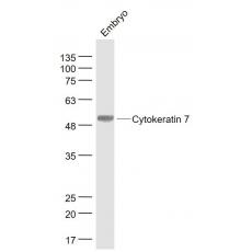 Anti-Cytokeratin 7 antibody