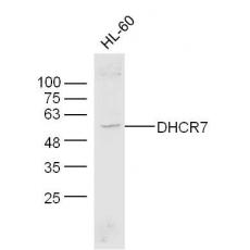 Anti-DHCR7 antibody