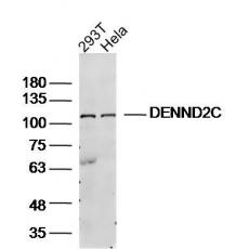 Anti-DENND2C antibody