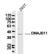 Anti-DNAJB11 antibody