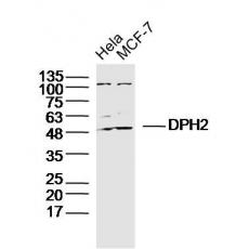 Anti-DPH2 antibody