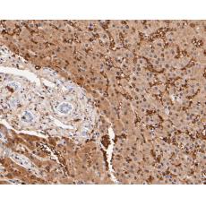 Anti-Aldolase B antibody