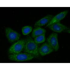 Anti-ZAC antibody