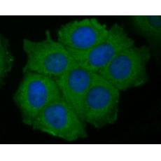 Anti-P2X7 antibody