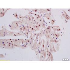 Anti-DNase gamma antibody