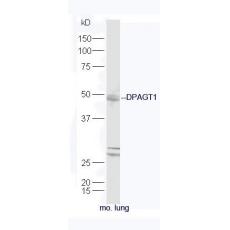 Anti-DPAGT1 antibody