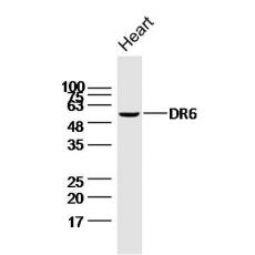 Anti-DR6 antibody