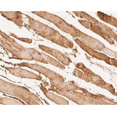Anti-KCNK18 antibody