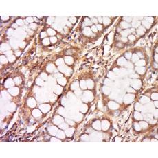 Anti-DNCLI1 antibody