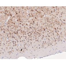 Anti-KCNB1 antibody