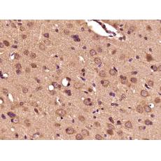 Anti-Dopamine beta Hydroxylase antibody