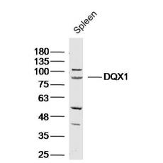Anti-DQX1 antibody