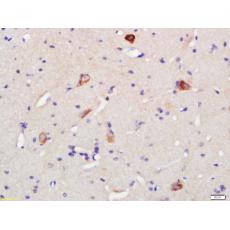 Anti-5HT1F Receptor antibody