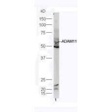Anti-ADAM11 antibody