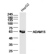 Anti-ADAM15 antibody