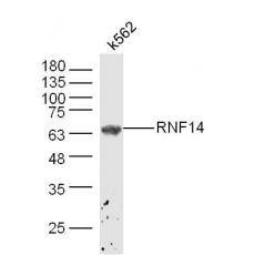 Anti-ADAM2 antibody
