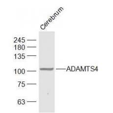 Anti-ADAMTS4 antibody