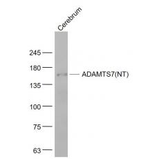 Anti-ADAMTS7(NT) antibody