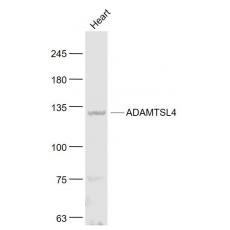Anti-ADAMTSL4 antibody