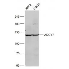Anti-ADCY7 antibody