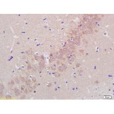 Anti-ADAMTS5 antibody