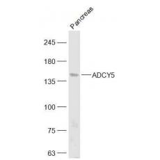 Anti-ADCY5 antibody