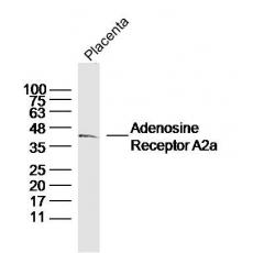 Anti-Adenosine Receptor A2a antibody