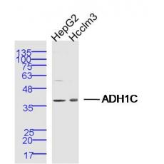 Anti-ADH1C antibody