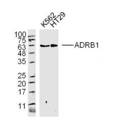 Anti-ADRB1 antibody