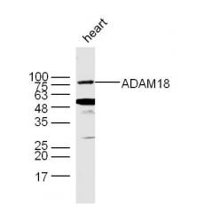 Anti-ADAM18 antibody