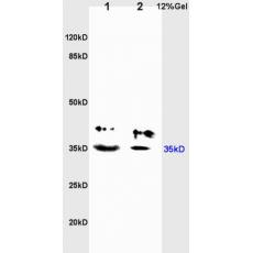 Anti-Adenosine A3 Receptor antibody