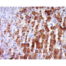 Anti-ADRB3 antibody