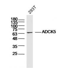 Anti-ADCK5 antibody