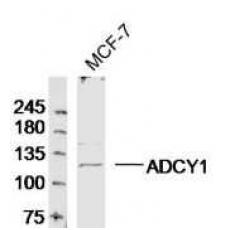 Anti-Adenylate cyclase 1 antibody