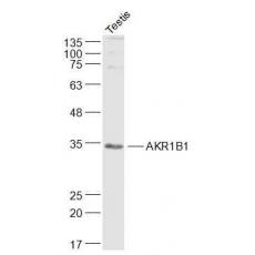 Anti-AKR1B1 antibody