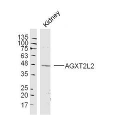 Anti-AGXT2L2 antibody