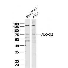 Anti-ALOX12 antibody