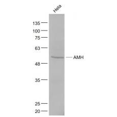 Anti-AMH antibody