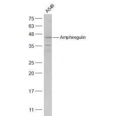 Anti-Amphiregulin antibody