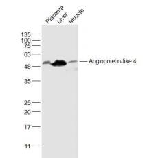 Anti-Angiopoietin-like 4 antibody
